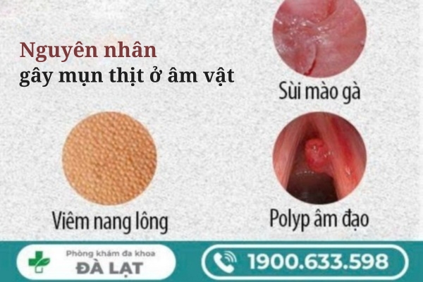 Hình ảnh minh họa